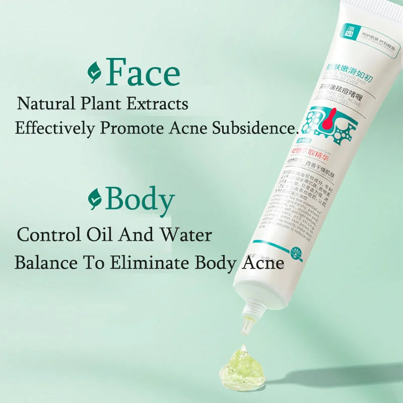 Herbal Acne Removal Face Cream Anti-Acne Mark Facial Care Set 100gm