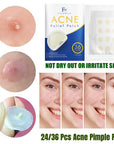 Flow Week Acne Pimple Patch Stickers 36 Dots 12mm