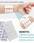 20pcs Suture Free Band-Aid Cut Wound Adhesive Bandage Medical Sterile Sticking Plaster Zipper Band Aid Incised Wound Tape A1667