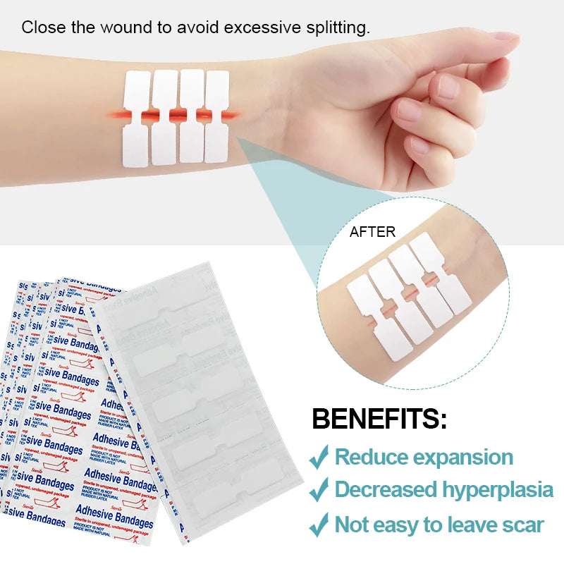 20pcs Suture Free Band-Aid Cut Wound Adhesive Bandage Medical Sterile Sticking Plaster Zipper Band Aid Incised Wound Tape A1667