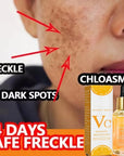 Vitamin C Whitening Dark Spots Freckles Fade Melanin RetinolSkincare 17ml