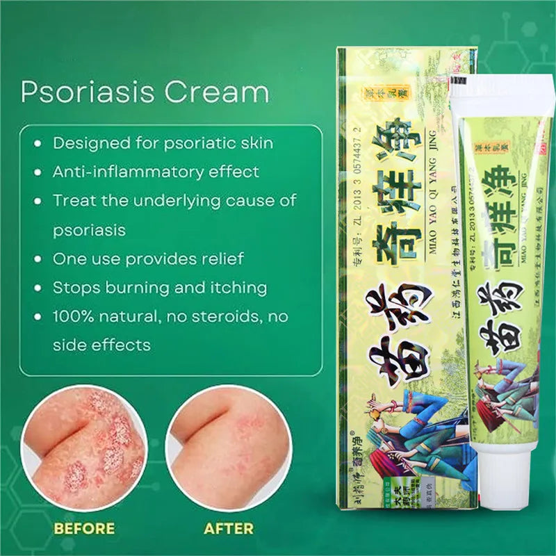 MIAO YAO QI YANG JING Natural Psoriasis Herbal Cream and Eczema Plaster