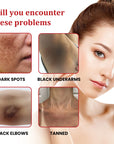 Powerful Dark Spot Remover Whitening Cream Remove Melasma Marks Lighten Melanin Improve Dull Brighten Skin Care Korean 30ml