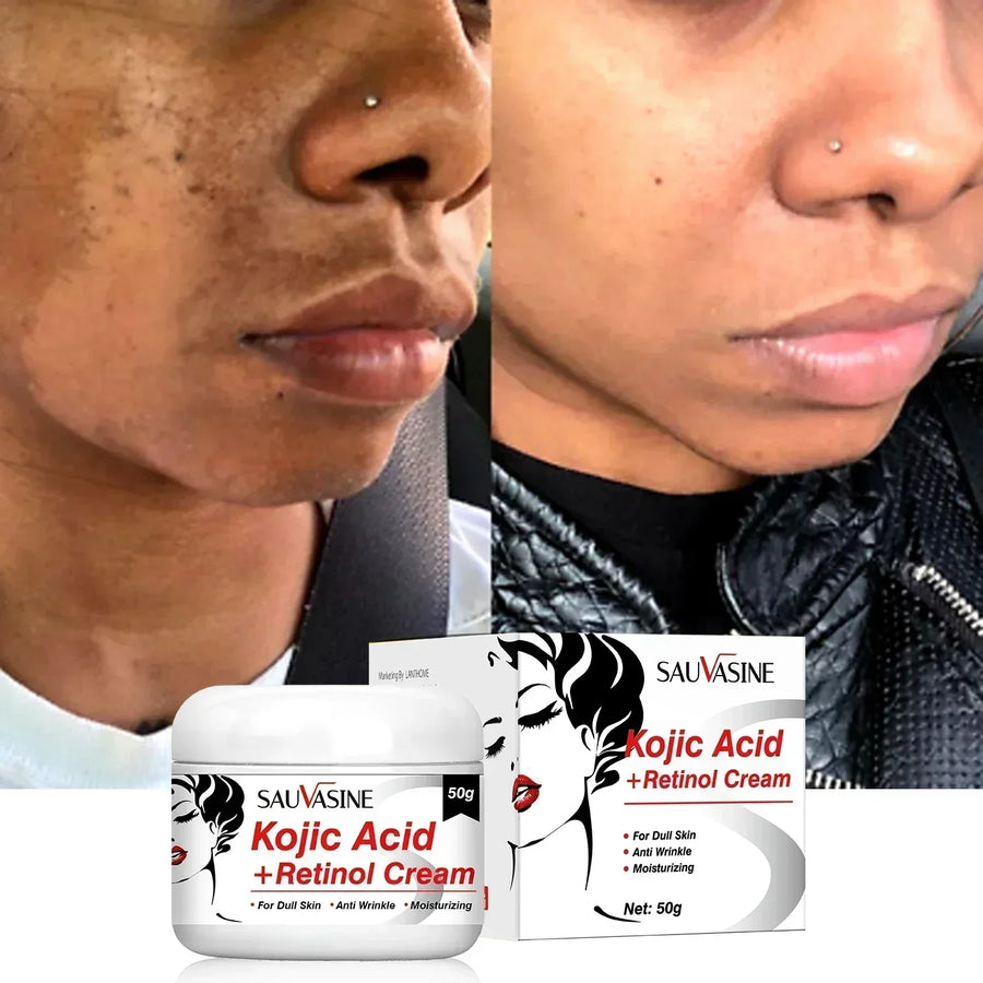 Kojic Acid Retinol Cream Skin Whitening Cream Remove Dark Spots Facial Skin Care