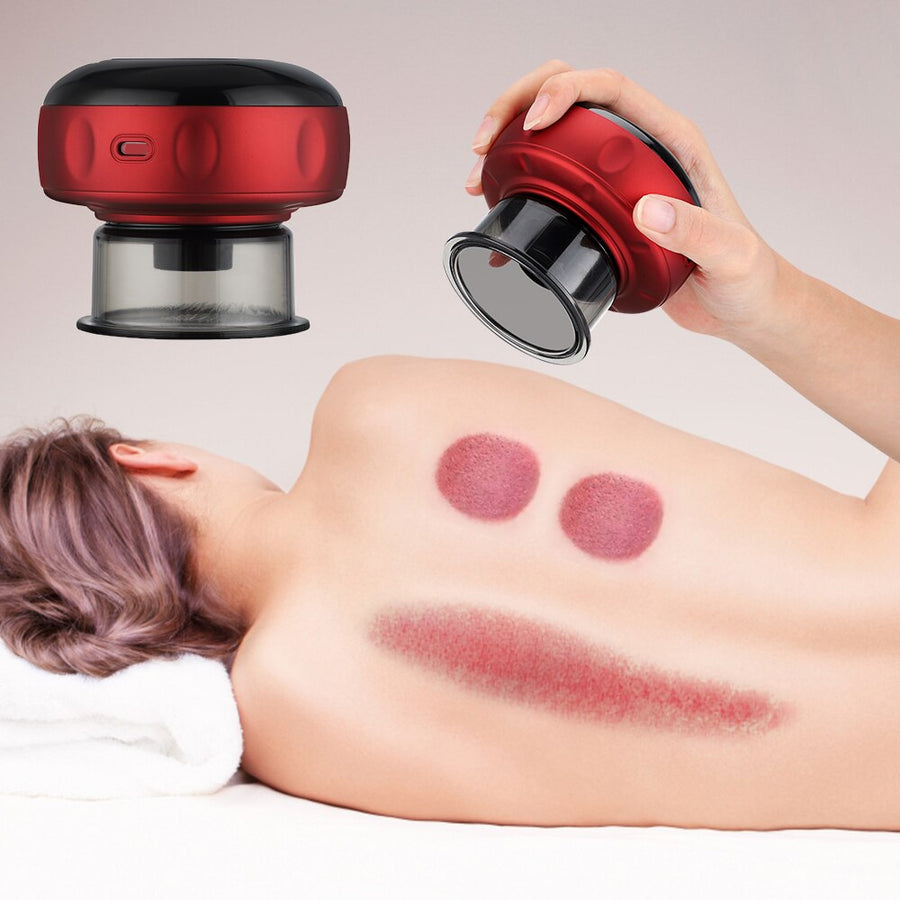 MIJIA Leravan Electric Cupping Massager