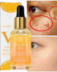 Vitamin C Whitening Dark Spots Freckles Fade Melanin RetinolSkincare 17ml