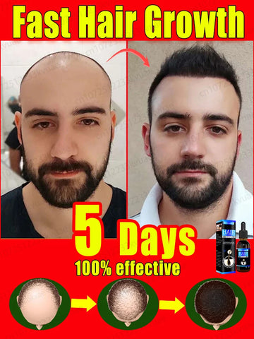 Hair growth oil rapid hair growth effective repair of baldness repair of hair follicles