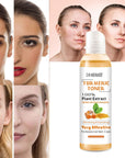 Turmeric Moisturizing Toner 100% plant Extract Dark Spots Eraser Acne Remover