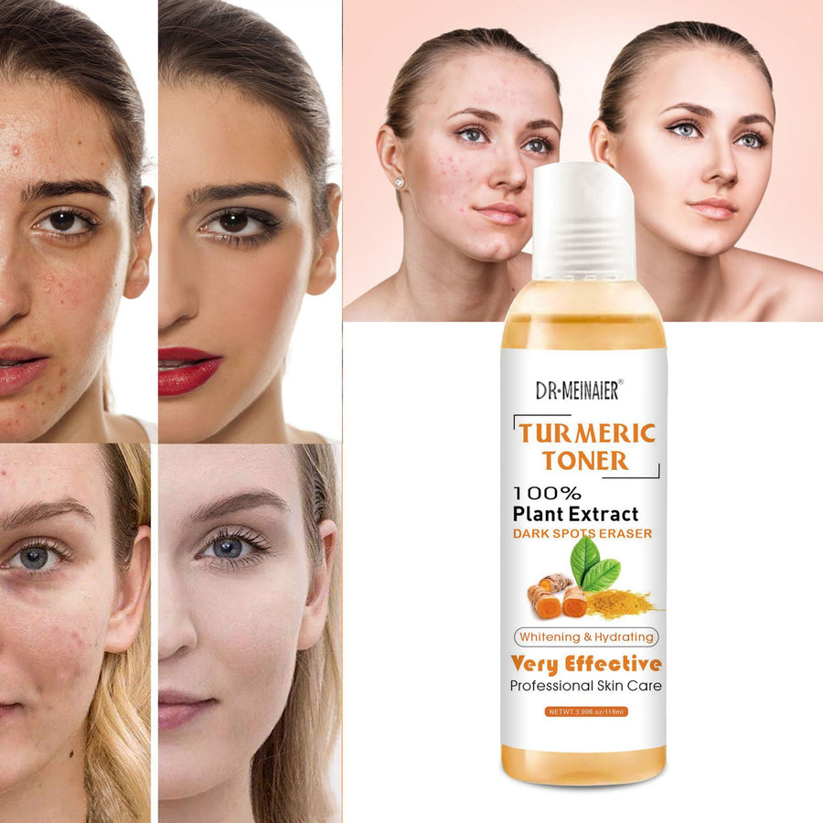 Turmeric Moisturizing Toner 100% plant Extract Dark Spots Eraser Acne Remover