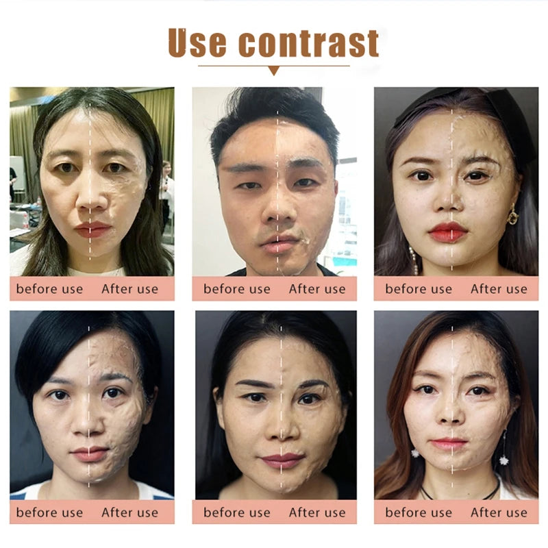 Korean Cosmetic Anti Aging Peptides DIY Face Mask Miracle Face Lifting Whitening Facial Mask