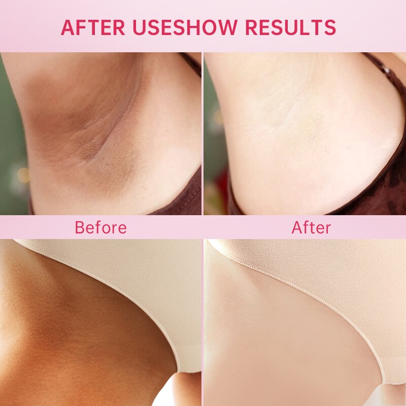 AUQUEST Body Whitening Cream Underarm