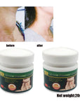 20G Herb Lymphatic Ointment Relieves Cervical Lymph Behind Auricular Lymph And Inguinal Lymph And Promotes Human Body Health