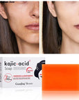 Kojic Sen Whitening Cream Lightening Face Soap Set For Black Skin Care 50g