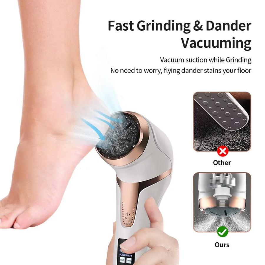 Electronic Foot Files Portable Electric Foot Callus Remover Foot Care Tool for Dead Hard Skin