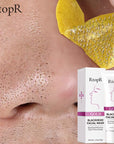 RtopR Gold Blackhead Facial Mask 40gm