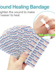 30pcs Zipper Band-Aid Medical Adhesive Bandage Sutured Band Aids Zipper Bandaid Sterile Bandages Promote Wound Healing A1668