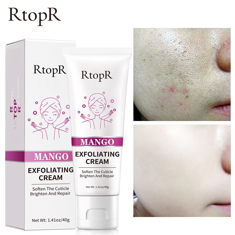 RtopR Mango Exfoliating Cream 40gm