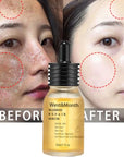 Powerful Dark Spot Remover Whitening Cream Remove Melasma Marks Lighten Melanin Improve Dull Brighten Skin Care Korean 30ml