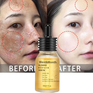 Powerful Dark Spot Remover Whitening Cream Remove Melasma Marks Lighten Melanin Improve Dull Brighten Skin Care Korean 30ml