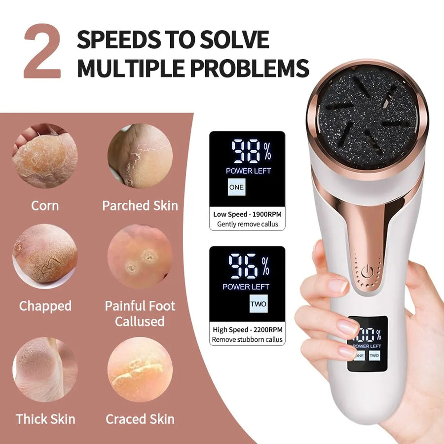 Electronic Foot Files Portable Electric Foot Callus Remover Foot Care Tool for Dead Hard Skin