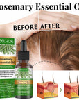 EELHOE Rosemary Essential Oil For Hair Growth 30ml