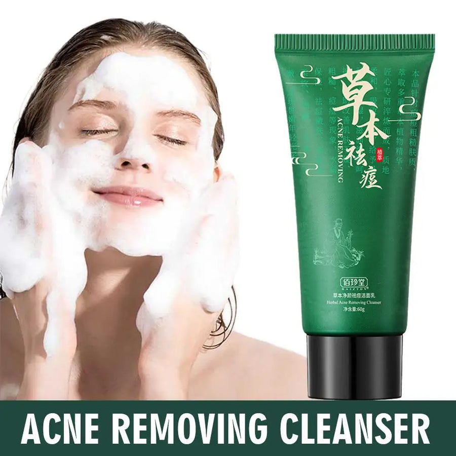 Acne Treatment Cleanser Blackhead Removal and Pore Control 60g