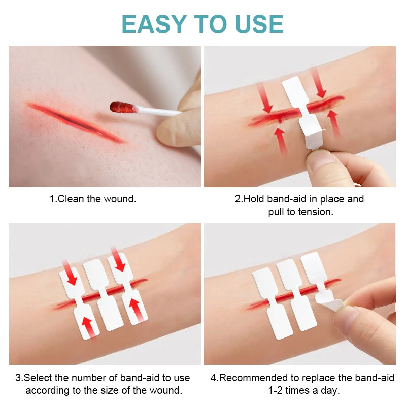 20pcs Suture Free Band-Aid Cut Wound Adhesive Bandage Medical Sterile Sticking Plaster Zipper Band Aid Incised Wound Tape A1667