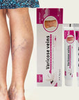 Varicose Vein Treat Cream Varicose Vein Vasculitis Ointment Relieves Spider Leg Vein Pain Phlebitis Medical Plaster Health Care