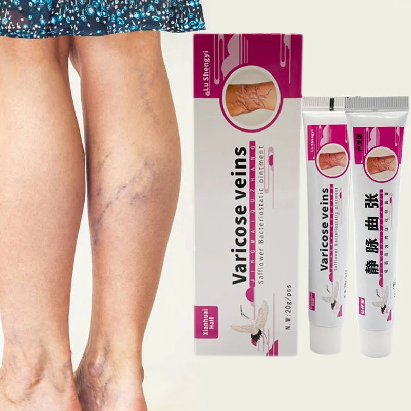 Varicose Vein Treat Cream Varicose Vein Vasculitis Ointment Relieves Spider Leg Vein Pain Phlebitis Medical Plaster Health Care