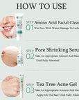 Herbal Acne Removal Face Cream Anti-Acne Mark Facial Care Set 100gm