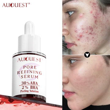 AUOUEST  Facial Serum Pore Skin Care Against Face Acne Pimple Acid Serum 40ml