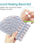 40pcs Suture Free Band-Aids Knife Wound Incised Wound Bandage Waterproof Zipper Band Aid  Medical Plaster First Aid Kit A1669