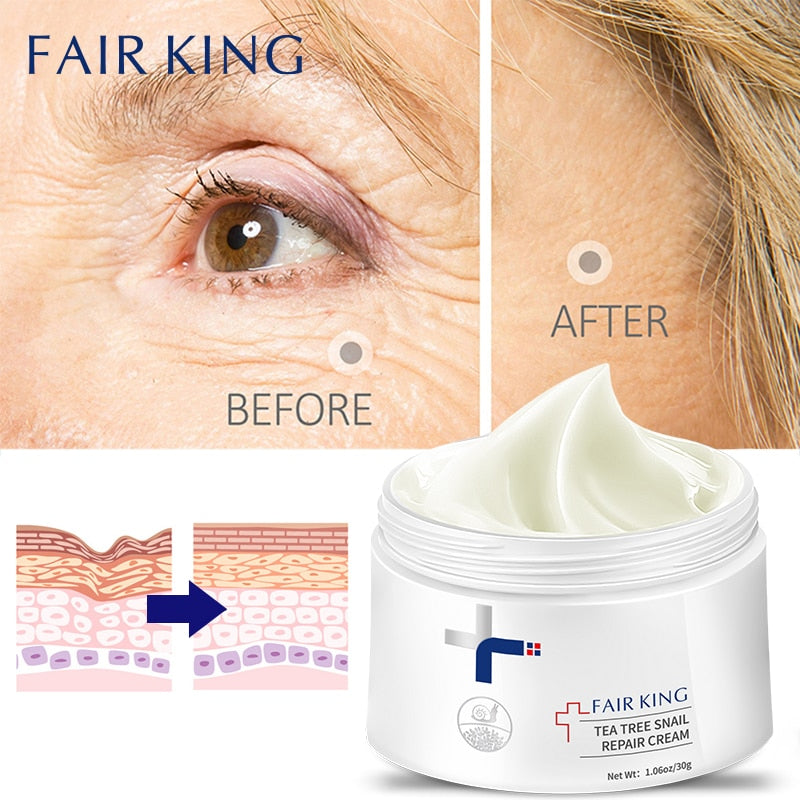 Fair King Tea Tree Skin Repair Cream 1.06oz/30g