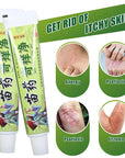 MIAO YAO QI YANG JING Natural Psoriasis Herbal Cream and Eczema Plaster