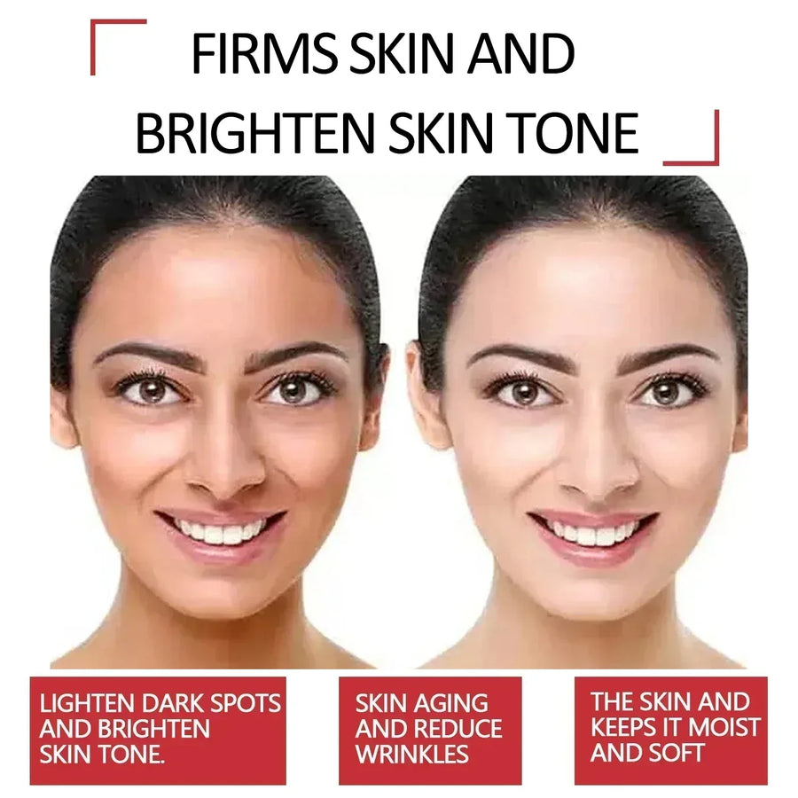 Kojic Acid Retinol Cream Skin Whitening Cream Remove Dark Spots Facial Skin Care