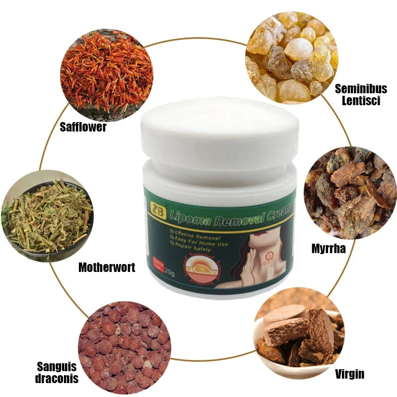 20G Herb Lymphatic Ointment Relieves Cervical Lymph Behind Auricular Lymph And Inguinal Lymph And Promotes Human Body Health