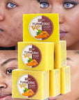 AILKE Natural Turmeric Soap for Face Body Lighten Brighten Skin Tone