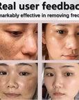 Powerful Dark Spot Remover Whitening Cream Remove Melasma Marks Lighten Melanin Improve Dull Brighten Skin Care Korean 30ml