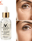 MeiYanQiong Gold Dynamisante Essence Anti Wrinkle