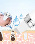 Ultrasonic Facial Cleaner ,Blackhead Removal Tool ,Skin Scrubber