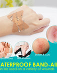 20pcs Better Fit For Joints Band-Aid Waterproof Thin Breathable Band Aid Medical Supplies Bandage Wound Dressing Plaster A1359