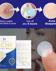 Flow Week Acne Pimple Patch Stickers 36 Dots 12mm