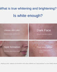 Whitening Spot Correction  Whitening Spot Brightening Complexion Cream