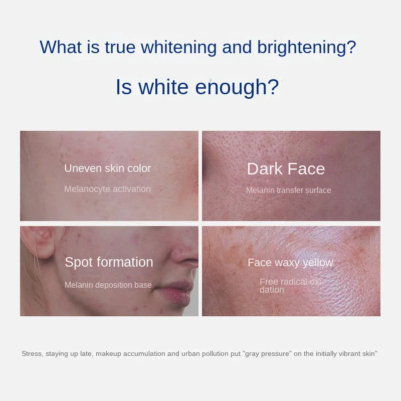 Whitening Spot Correction  Whitening Spot Brightening Complexion Cream