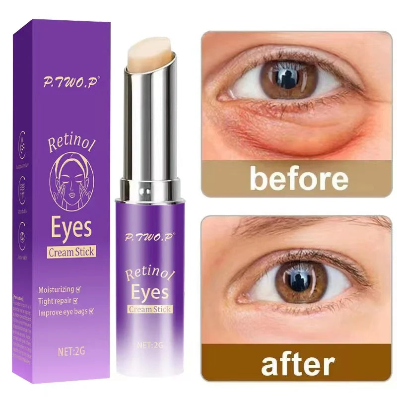 Retinol Eye Cream Stick, Moisturizing,  Fade Fine Lines,  Anti-wrinkle,  Anti Puffiness,  Brightening