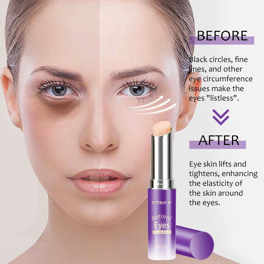 Retinol Eye Cream Stick, Moisturizing,  Fade Fine Lines,  Anti-wrinkle,  Anti Puffiness,  Brightening