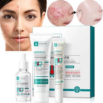 Herbal Acne Removal Face Cream Anti-Acne Mark Facial Care Set 100gm