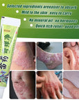 MIAO YAO QI YANG JING Natural Psoriasis Herbal Cream and Eczema Plaster