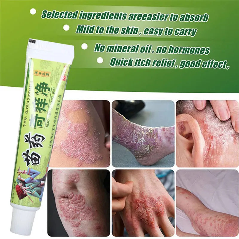 MIAO YAO QI YANG JING Natural Psoriasis Herbal Cream and Eczema Plaster