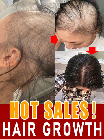 Hair Growth Products Fast Hair Growth Oil Anti Hair Loss Effective Hair Loss for woman or man